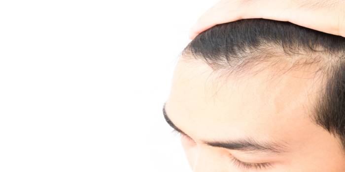 چگونه از ریزش مو جلوگیری کنیم و سلامت مو را بهبود ببخشیم