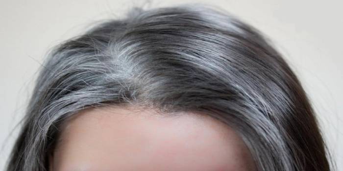 درمان‌های خانگی برای سفید شدن موی سر